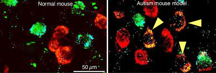 Autism neurotransmitter switching